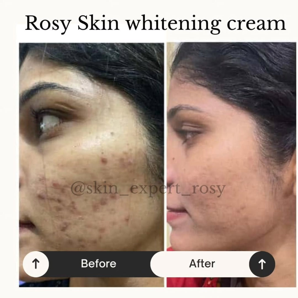 Skin Whitening Night Cream